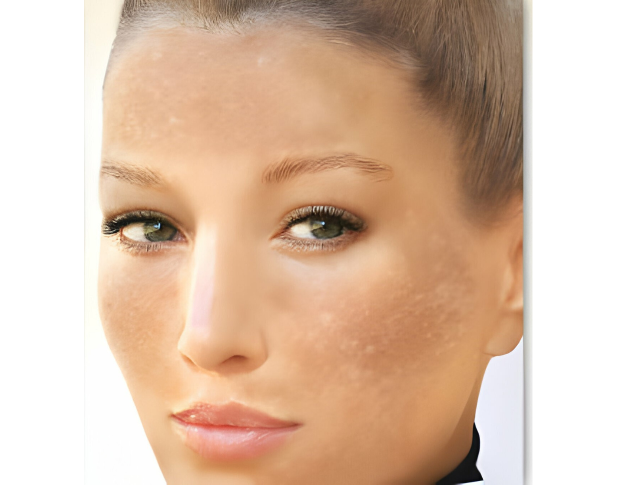 Saggy face